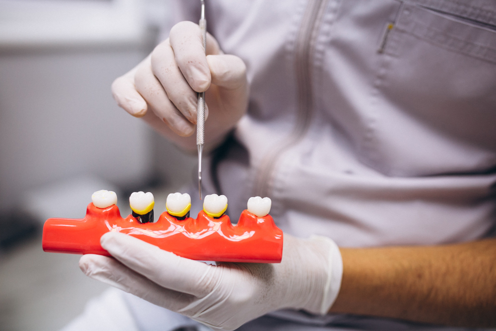 dentist demonstrating dental crows procedure