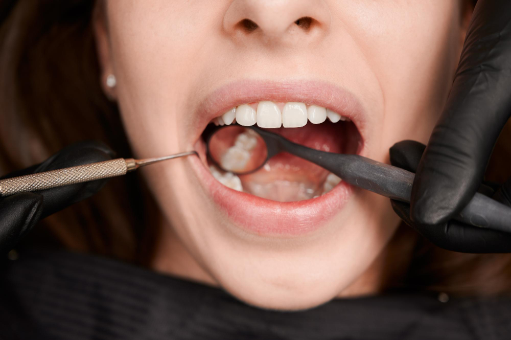 child during composite filling treatment