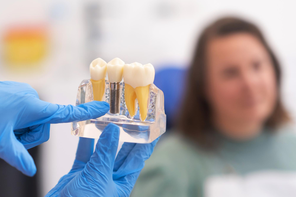 dentist showing patient what is single dental implants