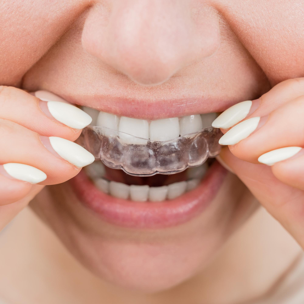 woman close-up wearing invisalign